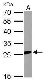 RGS2 Antibody in Western Blot (WB)