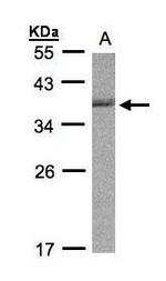 Cdc34 Antibody in Western Blot (WB)