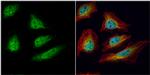 Cdc34 Antibody in Immunocytochemistry (ICC/IF)