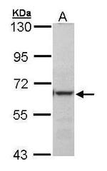 METTL3 Antibody in Western Blot (WB)