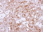 SEMA6A Antibody in Immunohistochemistry (Paraffin) (IHC (P))