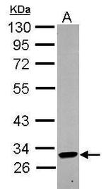 KIR2DL4 Antibody in Western Blot (WB)