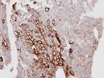 Cytokeratin 6 Antibody in Immunohistochemistry (Paraffin) (IHC (P))