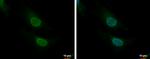 CNOT8 Antibody in Immunocytochemistry (ICC/IF)