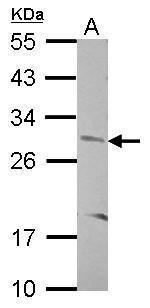 CNOT8 Antibody in Western Blot (WB)