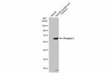 Protein C Antibody in Western Blot (WB)