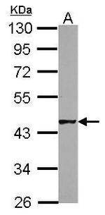 HSFY1/HSFY2 Antibody in Western Blot (WB)