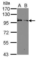 KELL Antibody in Western Blot (WB)