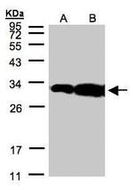 HOXC11 Antibody in Western Blot (WB)