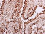 WNK1 Antibody in Immunohistochemistry (Paraffin) (IHC (P))