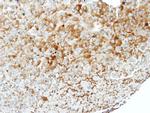 WNK1 Antibody in Immunohistochemistry (Paraffin) (IHC (P))