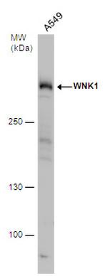 WNK1 Antibody in Western Blot (WB)