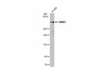 WNK1 Antibody in Western Blot (WB)