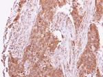 ACK1 Antibody in Immunohistochemistry (Paraffin) (IHC (P))