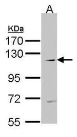 ACK1 Antibody in Western Blot (WB)