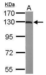 ACK1 Antibody in Western Blot (WB)