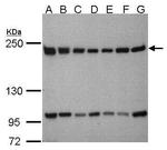 TAF172 Antibody in Western Blot (WB)