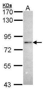 RNF6 Antibody in Western Blot (WB)