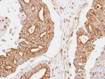 CCNDBP1 Antibody in Immunohistochemistry (Paraffin) (IHC (P))