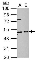 eIF2 beta Antibody in Western Blot (WB)