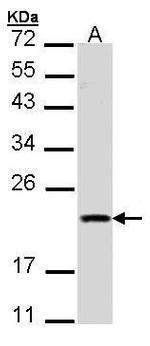 DIABLO Antibody in Western Blot (WB)