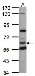 HACL1 Antibody in Western Blot (WB)