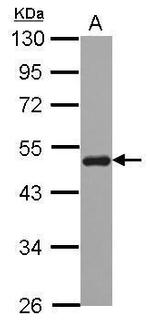 SNX5 Antibody in Western Blot (WB)