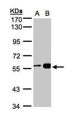 RCC2 Antibody in Western Blot (WB)
