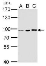 FGFR1 Antibody in Western Blot (WB)