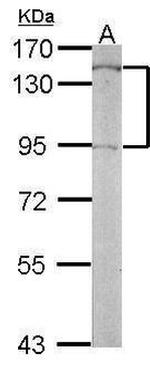 FGFR1 Antibody in Western Blot (WB)