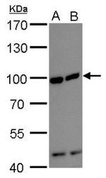 FGFR1 Antibody in Western Blot (WB)