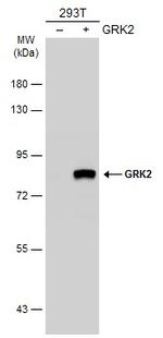 GRK2 Antibody in Western Blot (WB)