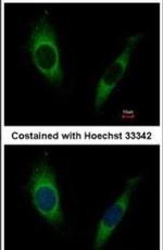 GRK2 Antibody in Immunocytochemistry (ICC/IF)