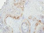 GRK2 Antibody in Immunohistochemistry (Paraffin) (IHC (P))