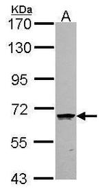 CoA Synthase Antibody in Western Blot (WB)