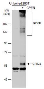 GPR30 Antibody in Western Blot (WB)