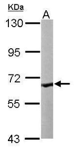 CoA Synthase Antibody in Western Blot (WB)