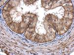 CoA Synthase Antibody in Immunohistochemistry (Paraffin) (IHC (P))