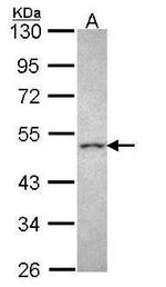 CRHR2 Antibody in Western Blot (WB)