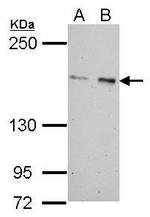 ROCK2 Antibody in Western Blot (WB)