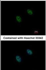 DUSP2 Antibody in Immunocytochemistry (ICC/IF)