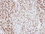 DUSP2 Antibody in Immunohistochemistry (Paraffin) (IHC (P))