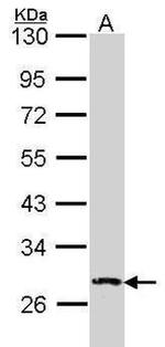 DUSP2 Antibody in Western Blot (WB)