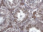 eRF1 Antibody in Immunohistochemistry (Paraffin) (IHC (P))