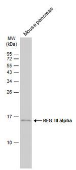 REG3A Antibody in Western Blot (WB)