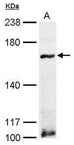 P-Glycoprotein Antibody in Western Blot (WB)