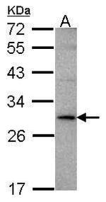 TL1A Antibody in Western Blot (WB)