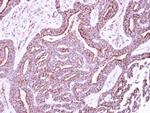 P2X5 Antibody in Immunohistochemistry (Paraffin) (IHC (P))