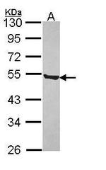 P2X5 Antibody in Western Blot (WB)