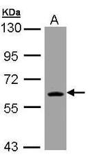 TrxR1 Antibody in Western Blot (WB)